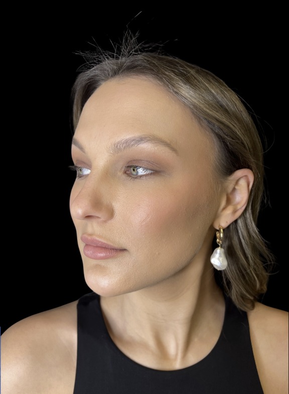 JLyft Non-Surgical Facelift after treatment at Juvly Aesthetics