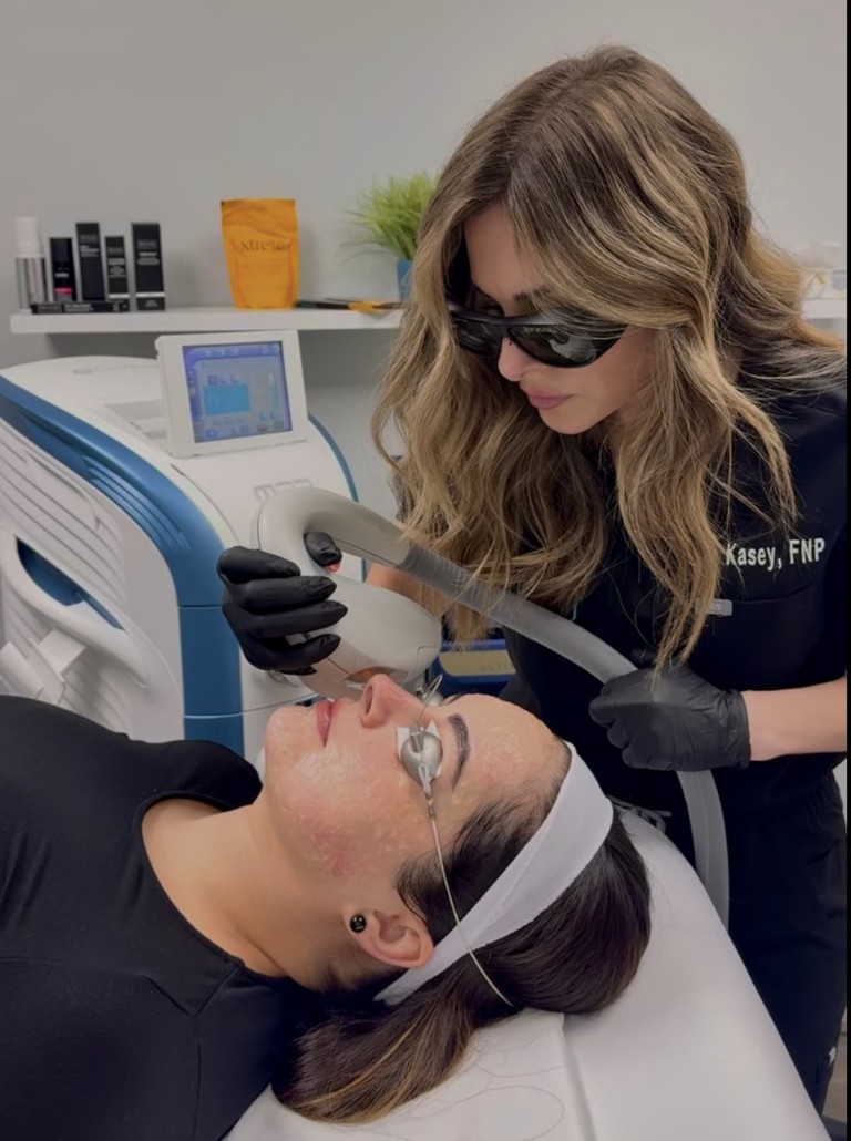 Juvly provider performing a laser treatment