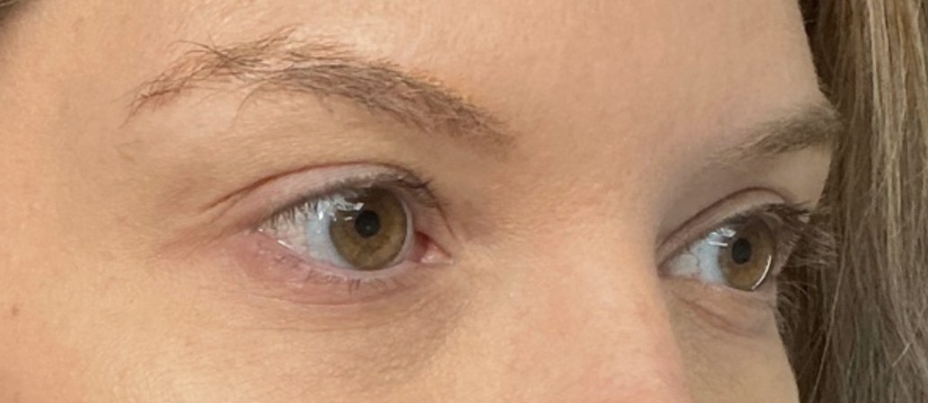 Lash and brow before treatment at Juvly Aesthetics