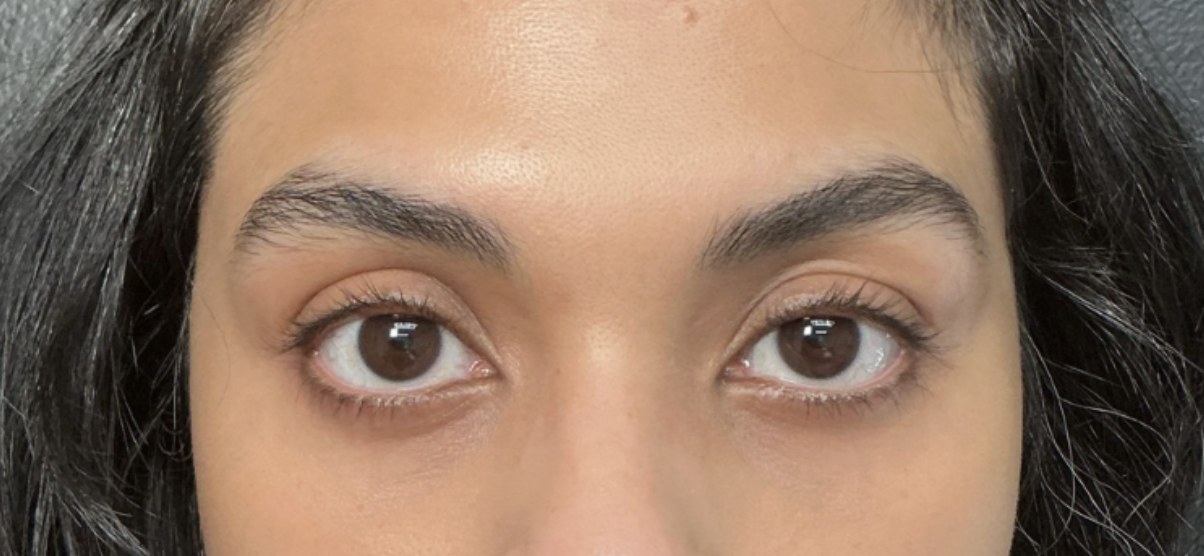 Lash and brow before treatment at Juvly Aesthetics