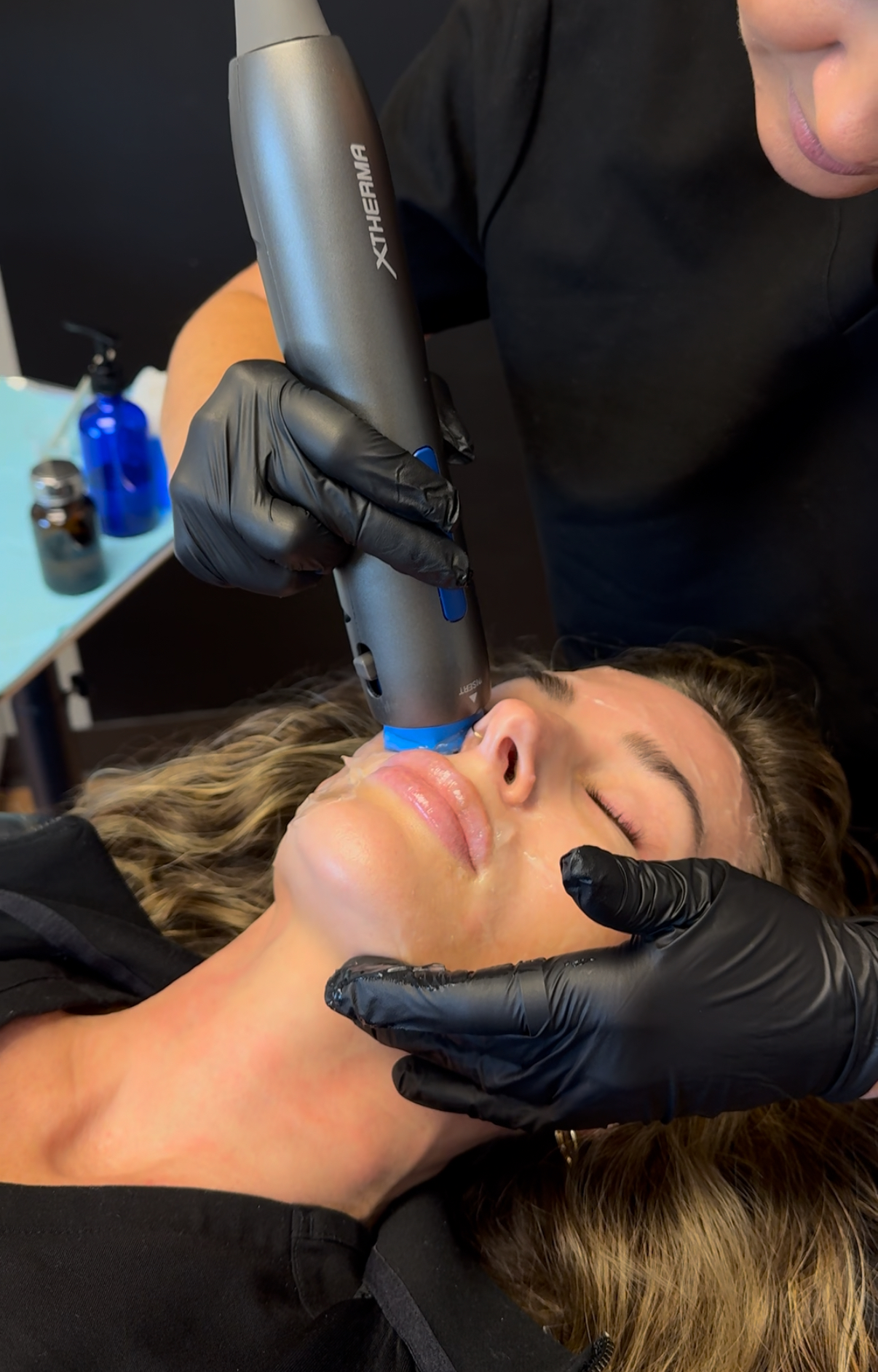 Provider treating a client's cheek with the XTherma handpiece at Juvly Aesthetics