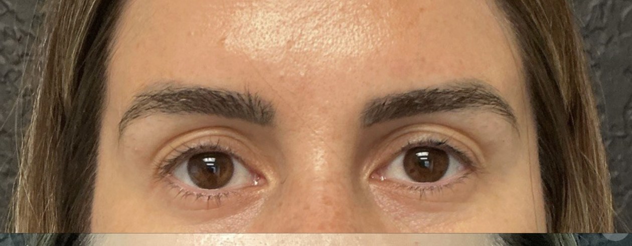 Lash and brow before treatment at Juvly Aesthetics