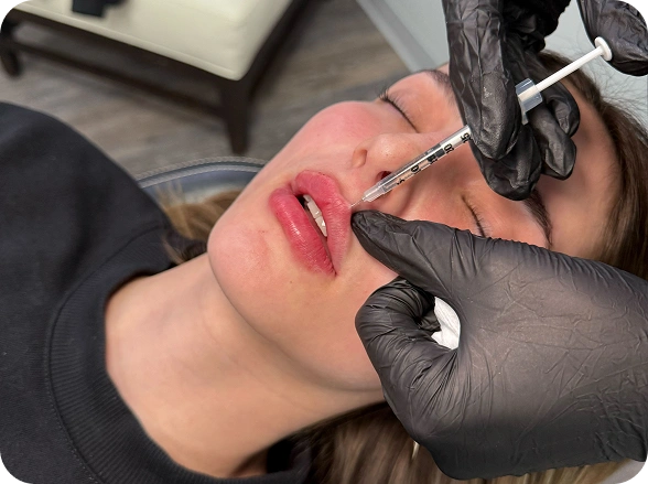 Provider injecting hyaluronic acid lip filler at Juvly Aesthetics