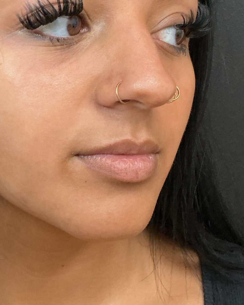 Lip filler before treatment at Juvly Aesthetics
